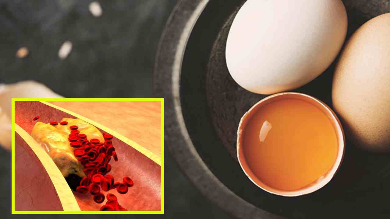 High Cholesterol : అధిక కొలెస్ట్రాల్ సమస్యతో బాధపడుతున్న వారు గుడ్డుకు దూరంగా ఉండటం మంచిదా? High Cholesterol : అధిక కొలెస్ట్రాల్ సమస్యతో బాధపడుతున్న వారు గుడ్డుకు దూరంగా ఉండటం మంచిదా?