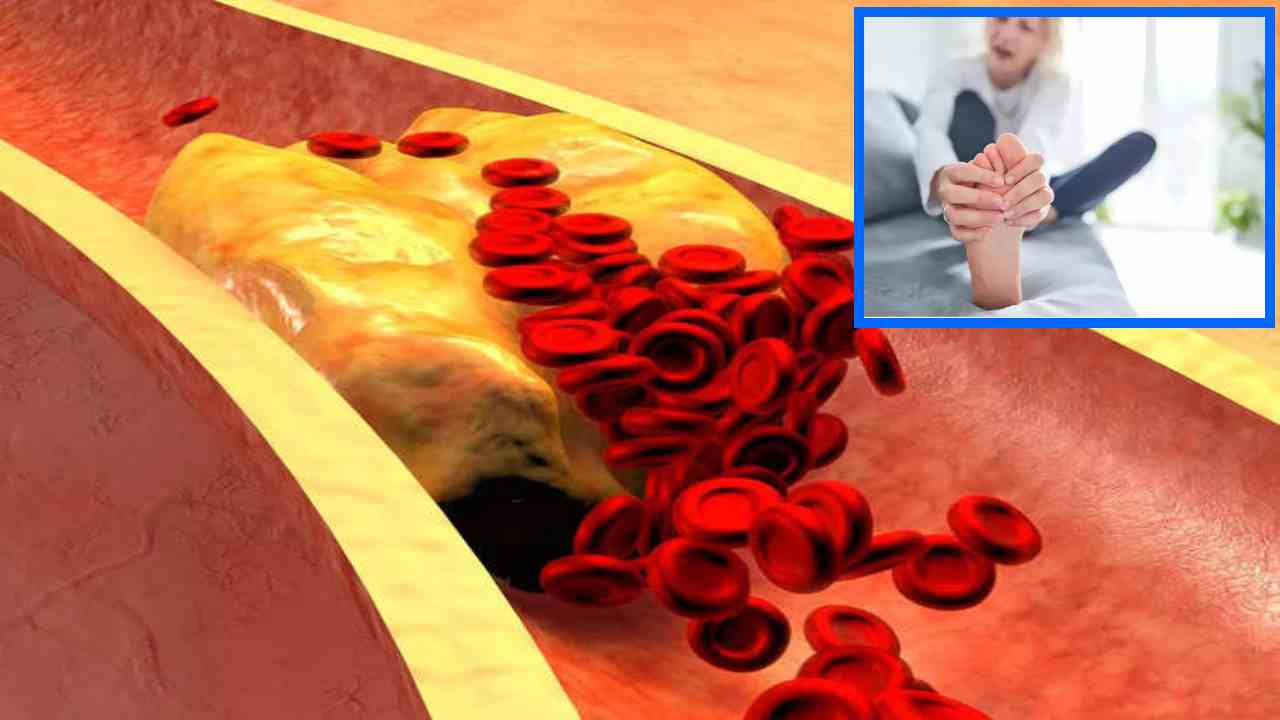 High Cholesterol : కాళ్ళ నొప్పులు, తిమ్మురులతో ఇబ్బంది పడుతున్నారా? అధిక కొలెస్ట్రాల్ సమస్యతో బాధపడుతున్నట్లేనా? High Cholesterol : కాళ్ళ నొప్పులు, తిమ్మురులతో ఇబ్బంది పడుతున్నారా? అధిక కొలెస్ట్రాల్ సమస్యతో బాధపడుతున్నట్లేనా?
