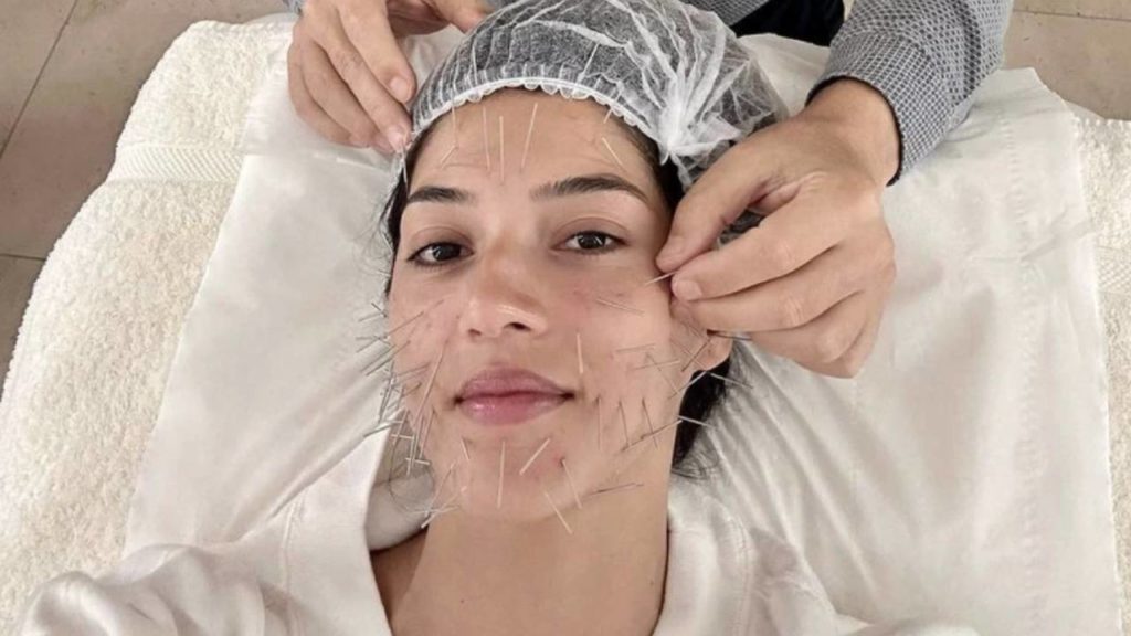 Actress Mehreen Face With Needles Will Shock You