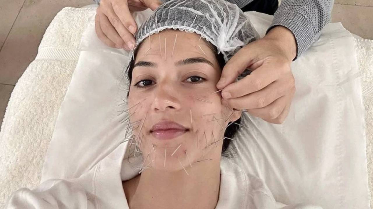 Mehreen: ముఖంపై సూదులు గుచ్చుకున్న హీరోయిన్.. ఎందుకో తెలుసా? Mehreen: ముఖంపై సూదులు గుచ్చుకున్న హీరోయిన్.. ఎందుకో తెలుసా?