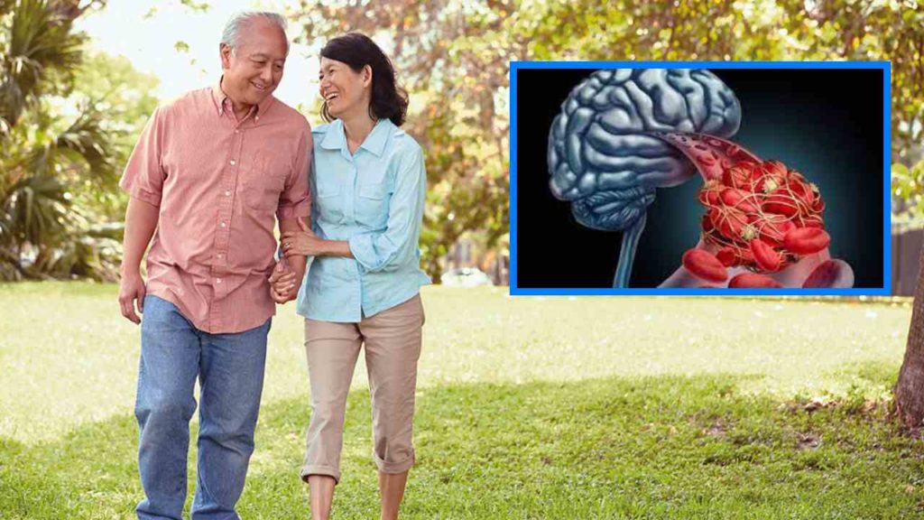 Lifestyle Modification for Secondary Stroke Prevention