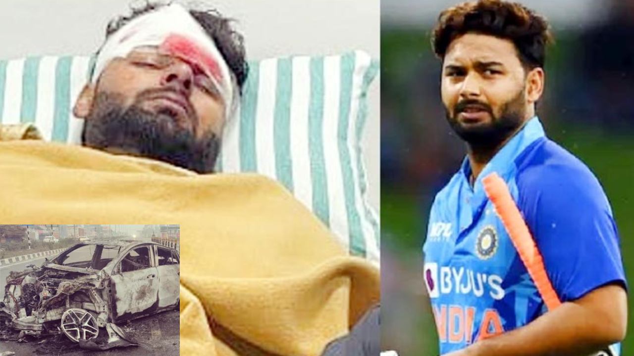 Rishabh Pant Injured : రిషబ్ పంత్ ముఖానికి ప్లాస్టిక్ సర్జరీ.. ఆస్పత్రిలో కోలుకుంటున్న క్రికెటర్ Rishabh Pant Injured : రిషబ్ పంత్ ముఖానికి ప్లాస్టిక్ సర్జరీ.. ఆస్పత్రిలో కోలుకుంటున్న క్రికెటర్