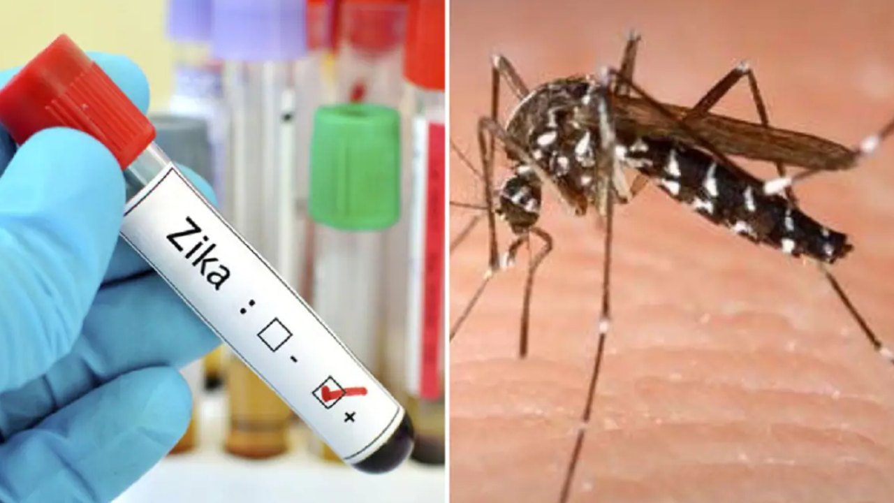 Zika Virus In Karnataka : కర్ణాటకలో జికా వైరస్ తొలి కేసు.. ఐదేళ్ల చిన్నారిలో గుర్తింపు Zika Virus In Karnataka : కర్ణాటకలో జికా వైరస్ తొలి కేసు.. ఐదేళ్ల చిన్నారిలో గుర్తింపు