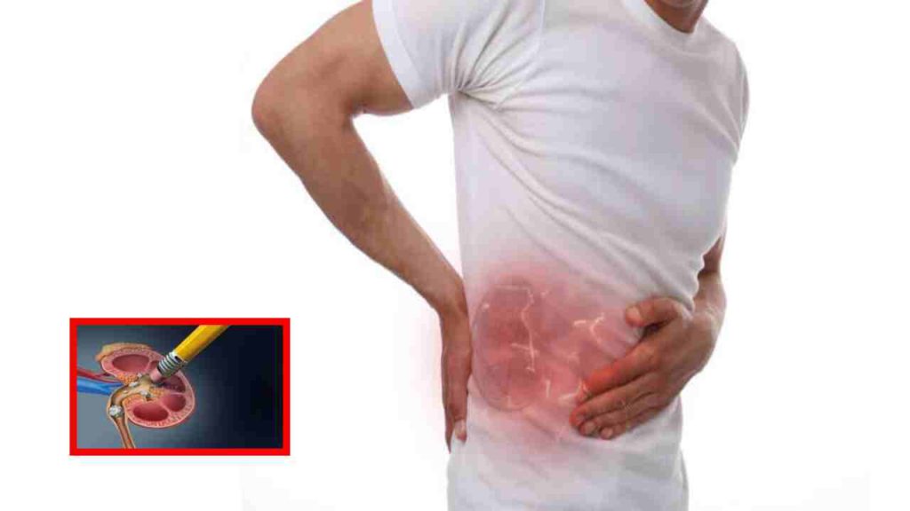 It is better to stay away from these to avoid the problem of kidney stones!