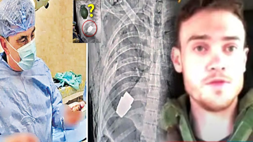 Live grenade removed from Ukrainian soldier's chest