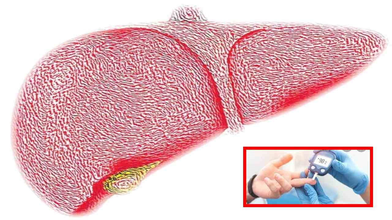 Diabetes : మధుమేహులు కాలేయం విషయంలో తీసుకోవాల్సిన జాగ్రత్తలు! Diabetes : మధుమేహులు కాలేయం విషయంలో తీసుకోవాల్సిన జాగ్రత్తలు!