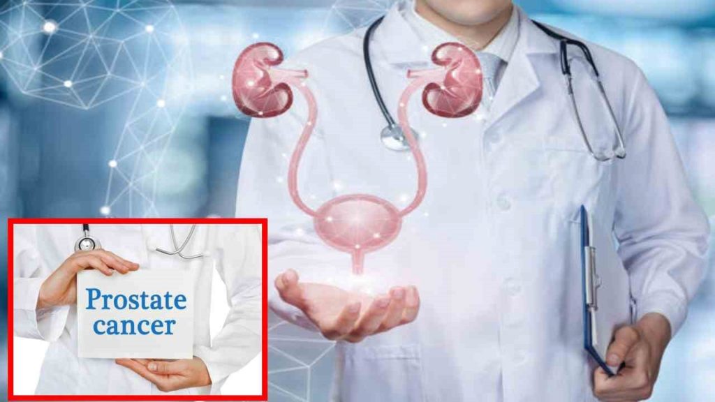 Prostate Cancer Risk :