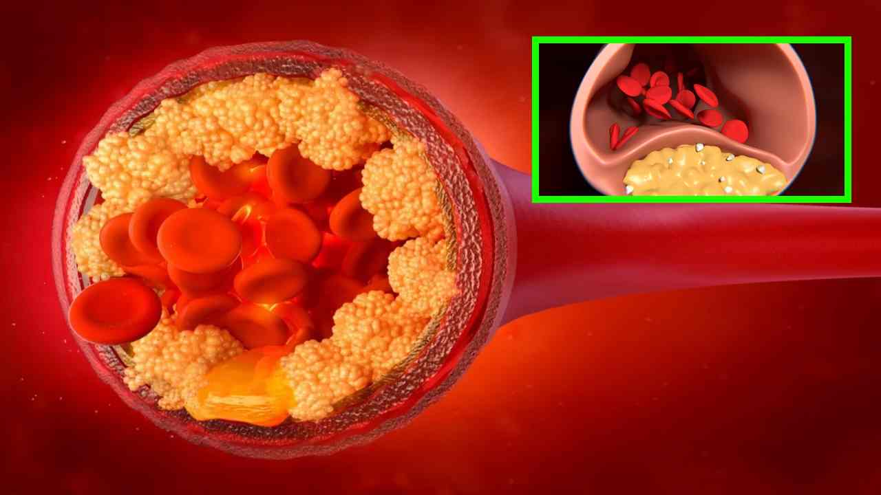 Bad Cholesterol : శరీరంలో చెడు కొలెస్ట్రాల్ తొలగిపోవాలంటే రోజువారిగా ఈ కూరగాయలను ఆహారంలో చేర్చుకోవటం మంచిది! Bad Cholesterol : శరీరంలో చెడు కొలెస్ట్రాల్ తొలగిపోవాలంటే రోజువారిగా ఈ కూరగాయలను ఆహారంలో చేర్చుకోవటం మంచిది!