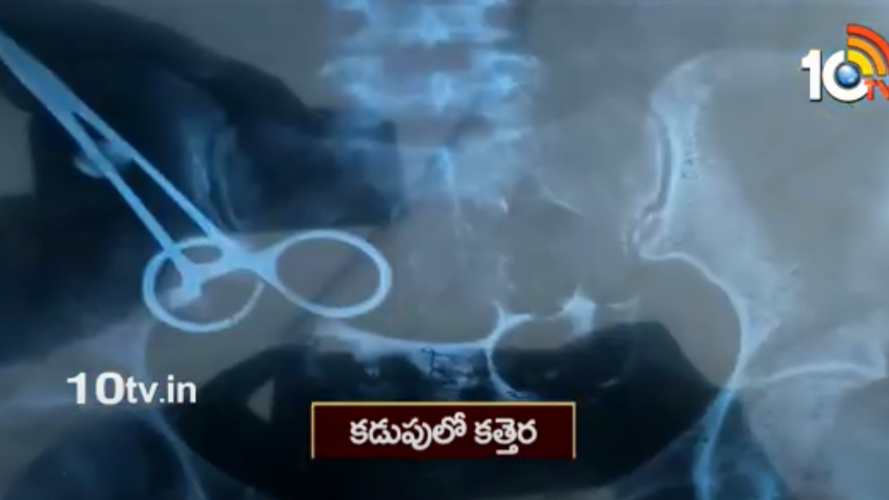 Doctor Negligence : ఆపరేషన్ అనంతరం కడుపులో కత్తెర మరిచిపోయిన డాక్టర్ Doctor Negligence : ఆపరేషన్ అనంతరం కడుపులో కత్తెర మరిచిపోయిన డాక్టర్