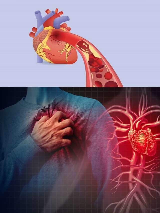 >గుండెపోటు ముప్పు ఎందుకు?