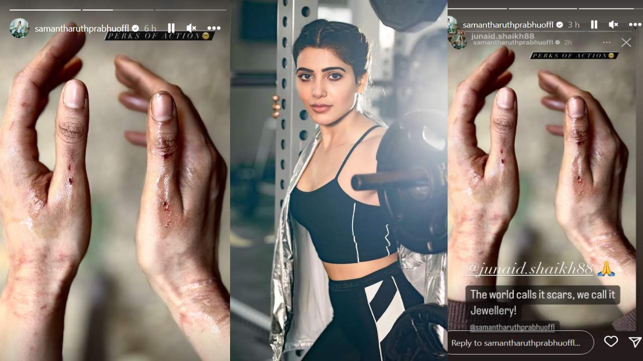 Samantha : షూటింగ్లో సమంతకు తీవ్ర గాయాలు.. Samantha : షూటింగ్లో సమంతకు తీవ్ర గాయాలు..