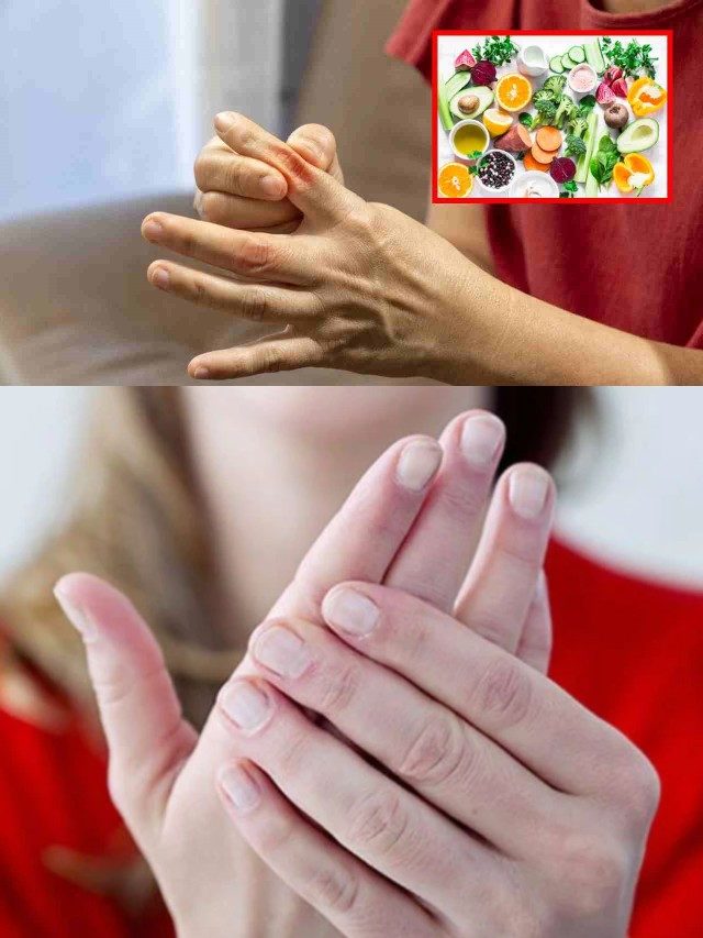 >యూరిక్‌ యాసిడ్‌ సమస్యతో బాధపడుతున్నవారు ఈ పండ్లను తినకపోవటమే మంచిది?