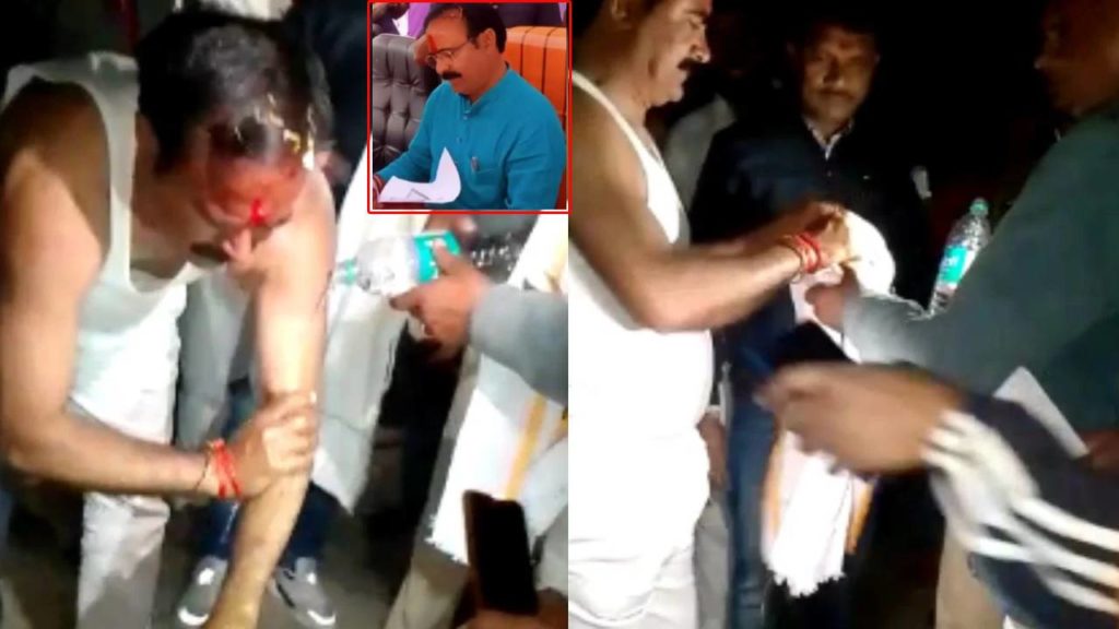 itching powder on minister Brijendra Singh Yadav