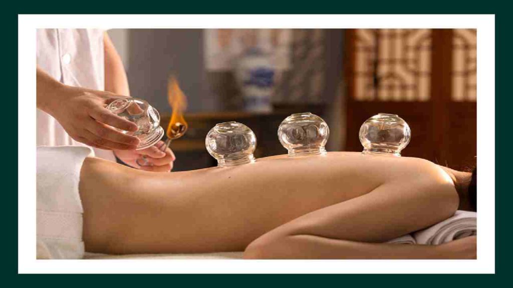 Cupping Therapy