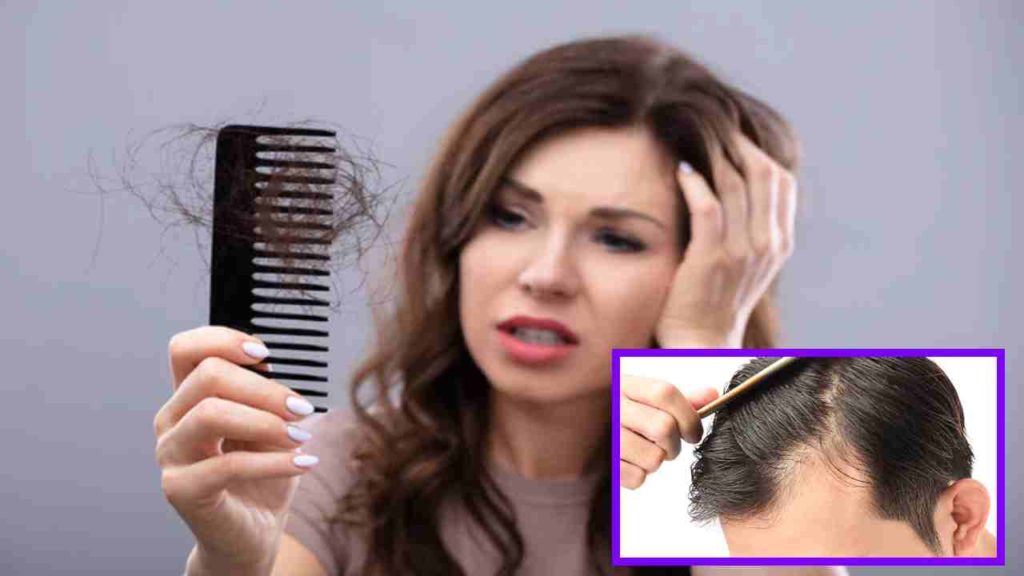 Hair Loss