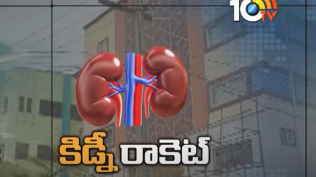 Kidney Racket