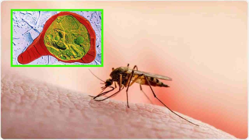 Malaria
