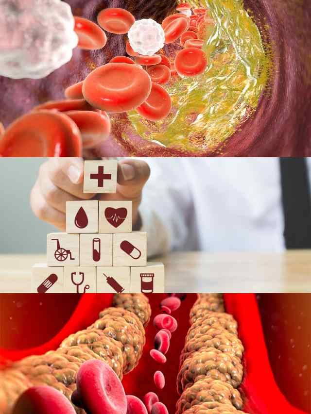 >కొలెస్ట్రాల్ తగ్గాలంటే?