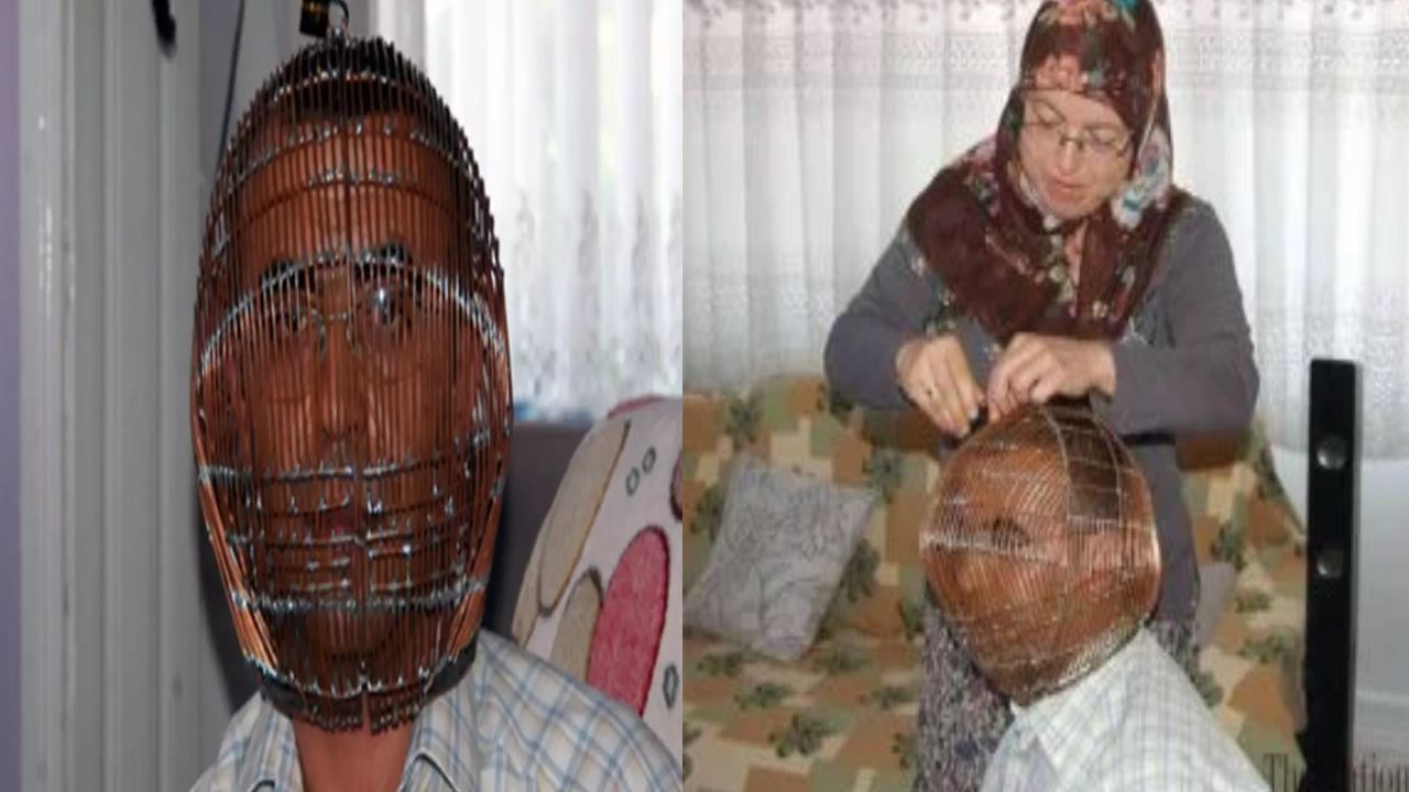 Turkey Man : ధూమపానం మానేయాలని మెటల్ బోనులో తలపెట్టాడు.. ఆ తరువాత ఏం జరిగింది? Turkey Man : ధూమపానం మానేయాలని మెటల్ బోనులో తలపెట్టాడు.. ఆ తరువాత ఏం జరిగింది?