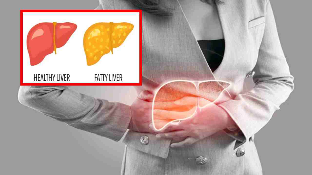 Non-Alcoholic Fatty Liver : ప్రాణాంతకంగా నాన్-ఆల్కహాలిక్ ఫ్యాటీ లివర్ డిసీజ్.. సమస్య నుండి బయటపడేందుకు మార్గాలు Non-Alcoholic Fatty Liver : ప్రాణాంతకంగా నాన్-ఆల్కహాలిక్ ఫ్యాటీ లివర్ డిసీజ్.. సమస్య నుండి బయటపడేందుకు మార్గాలు