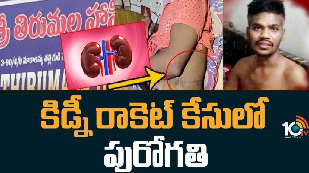 Visakha Kidney Racket Case