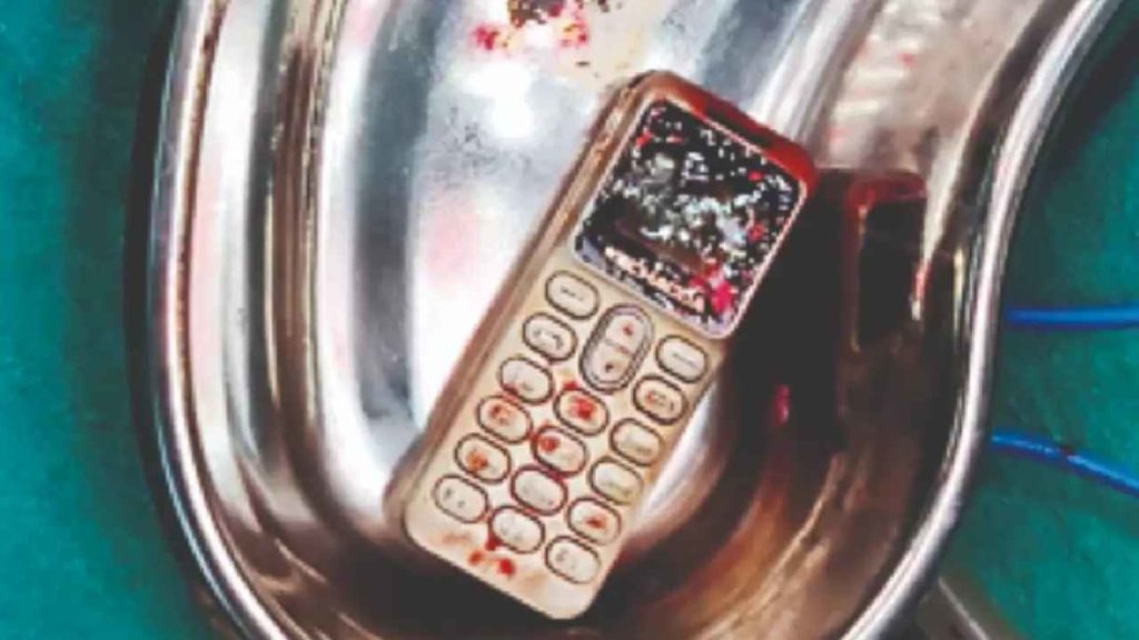 Woman Swallows Phone