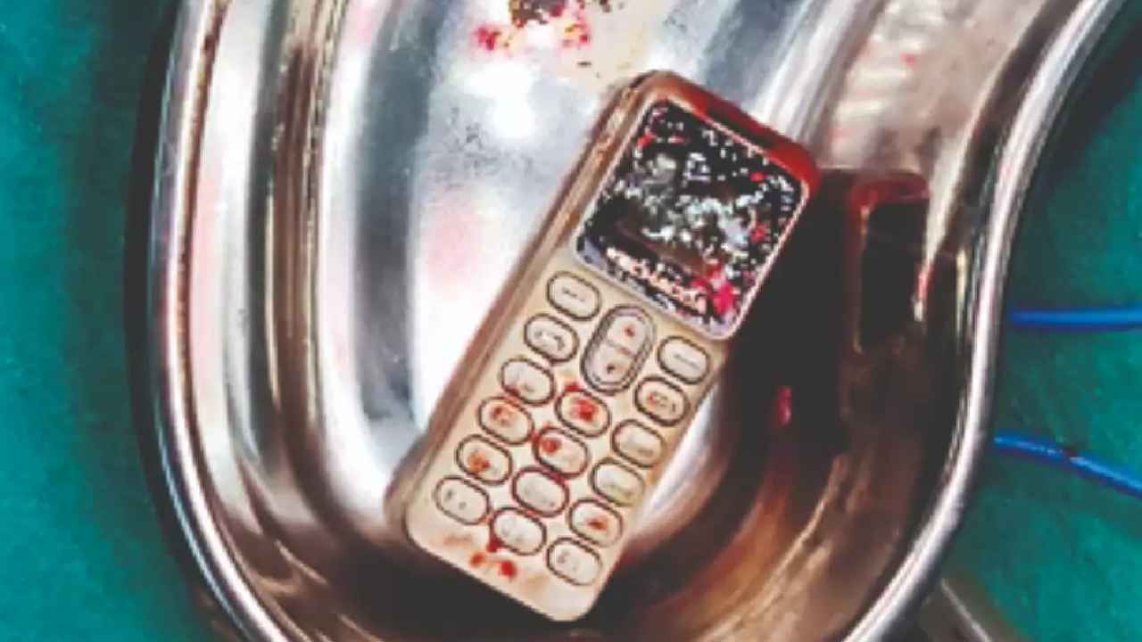 Woman Swallows Phone : బాబోయ్.. సోదరుడితో గొడవపడి ఫోన్ మింగేసిన యువతి, ఆ తర్వాత ఏం జరిగిందంటే.. Woman Swallows Phone : బాబోయ్.. సోదరుడితో గొడవపడి ఫోన్ మింగేసిన యువతి, ఆ తర్వాత ఏం జరిగిందంటే..