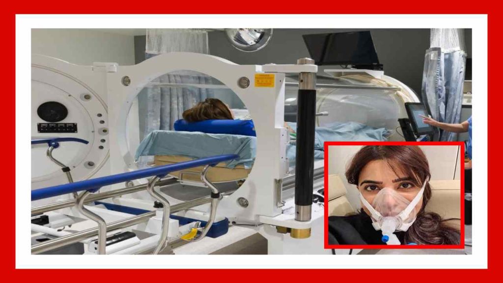 hyperbaric therapy
