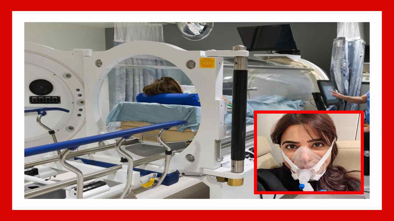 Hyperbaric Therapy : హైపర్బారిక్ థెరపీ చేయించుకున్న సమంతా రూత్ ప్రభు.. దీని ధర ఎంత, దేనికి ఉపయోగించబడుతుందంటే ? Hyperbaric Therapy : హైపర్బారిక్ థెరపీ చేయించుకున్న సమంతా రూత్ ప్రభు.. దీని ధర ఎంత, దేనికి ఉపయోగించబడుతుందంటే ?