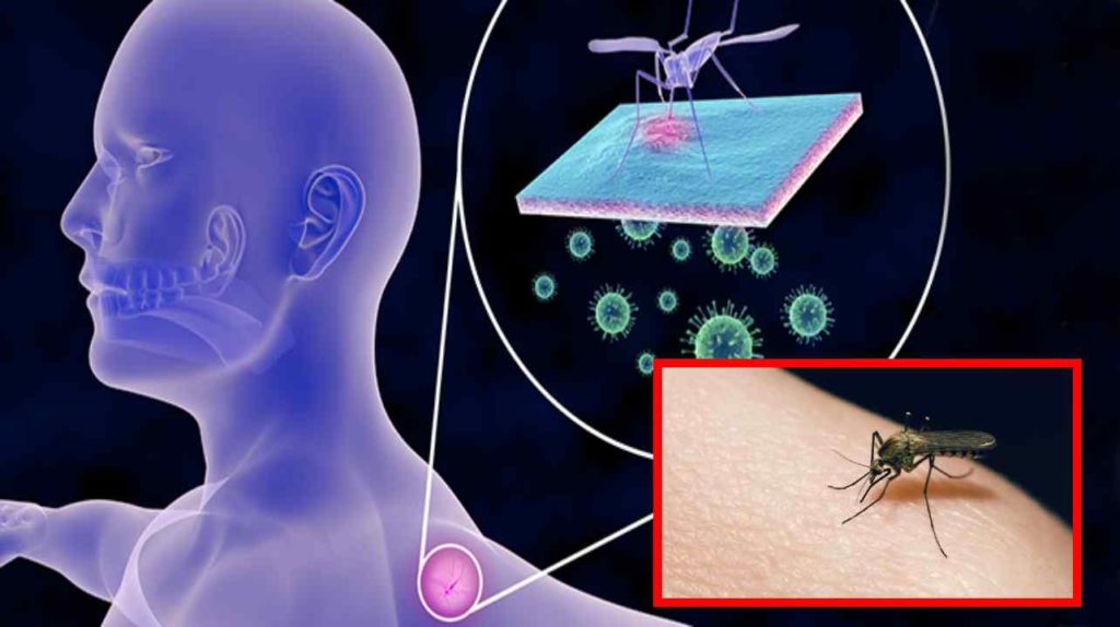 malaria mosquito bite