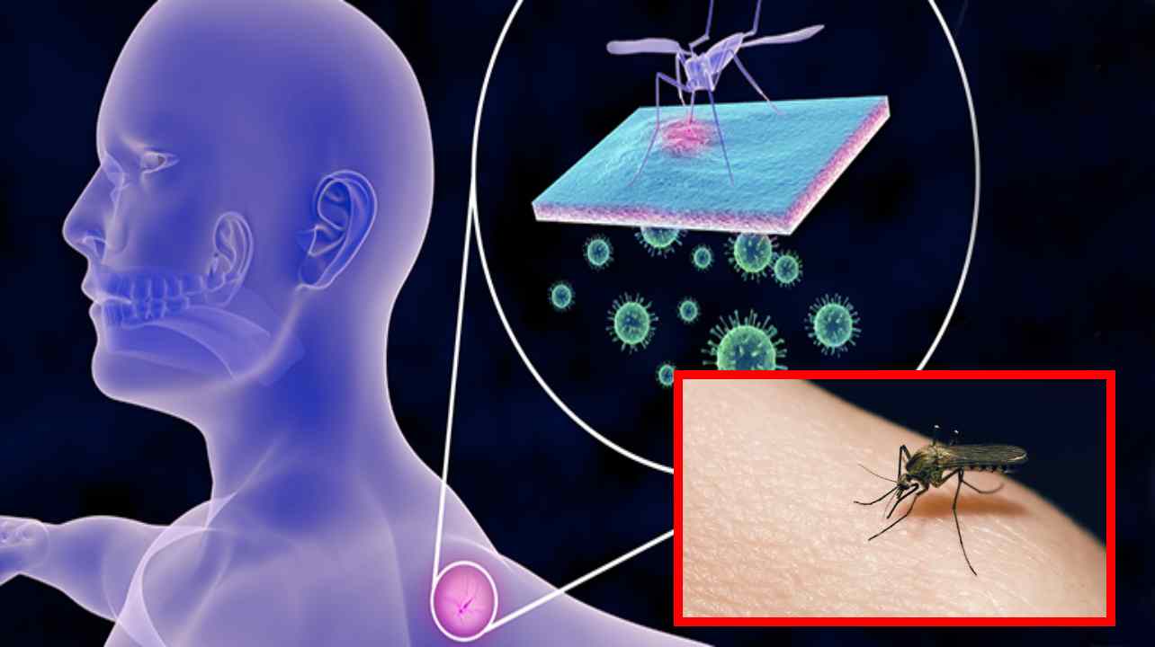 Malaria Mosquito Bite : మలేరియా దోమకాటు శరీరానికి ఎలాంటి హాని కలిగిస్తుందో తెలుసా ? Malaria Mosquito Bite : మలేరియా దోమకాటు శరీరానికి ఎలాంటి హాని కలిగిస్తుందో తెలుసా ?