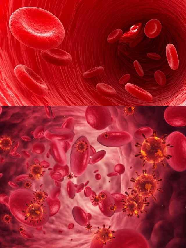 >బ్లడ్ క్యాన్సర్.. ముందస్తు సంకేతాలు ఇవే
