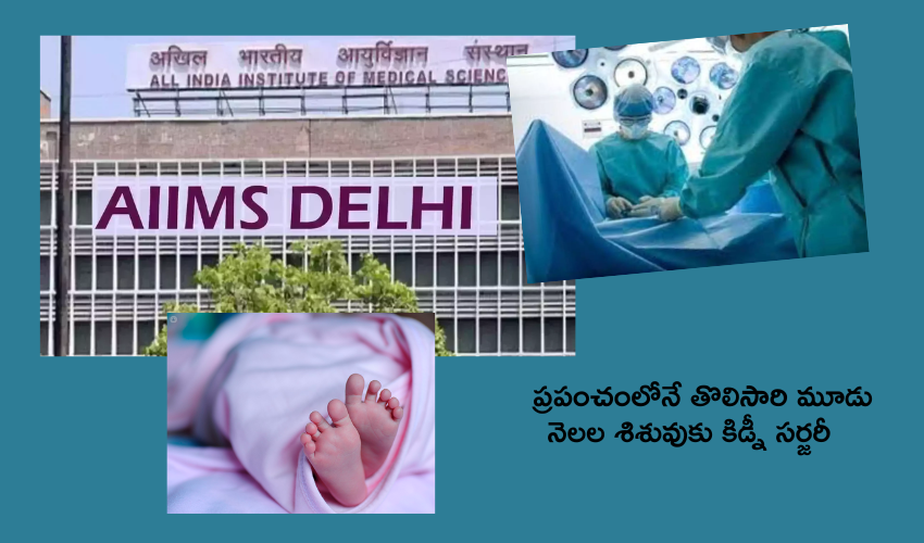 Delhi Aiims : మూడు నెలల పసిబిడ్డకు కిడ్నీ సర్జరీ .. ప్రపంచంలోనే తొలిసారి ఢిల్లీ ఎయిమ్స్ డాక్టర్ల ఘనత Delhi Aiims : మూడు నెలల పసిబిడ్డకు కిడ్నీ సర్జరీ .. ప్రపంచంలోనే తొలిసారి ఢిల్లీ ఎయిమ్స్ డాక్టర్ల ఘనత