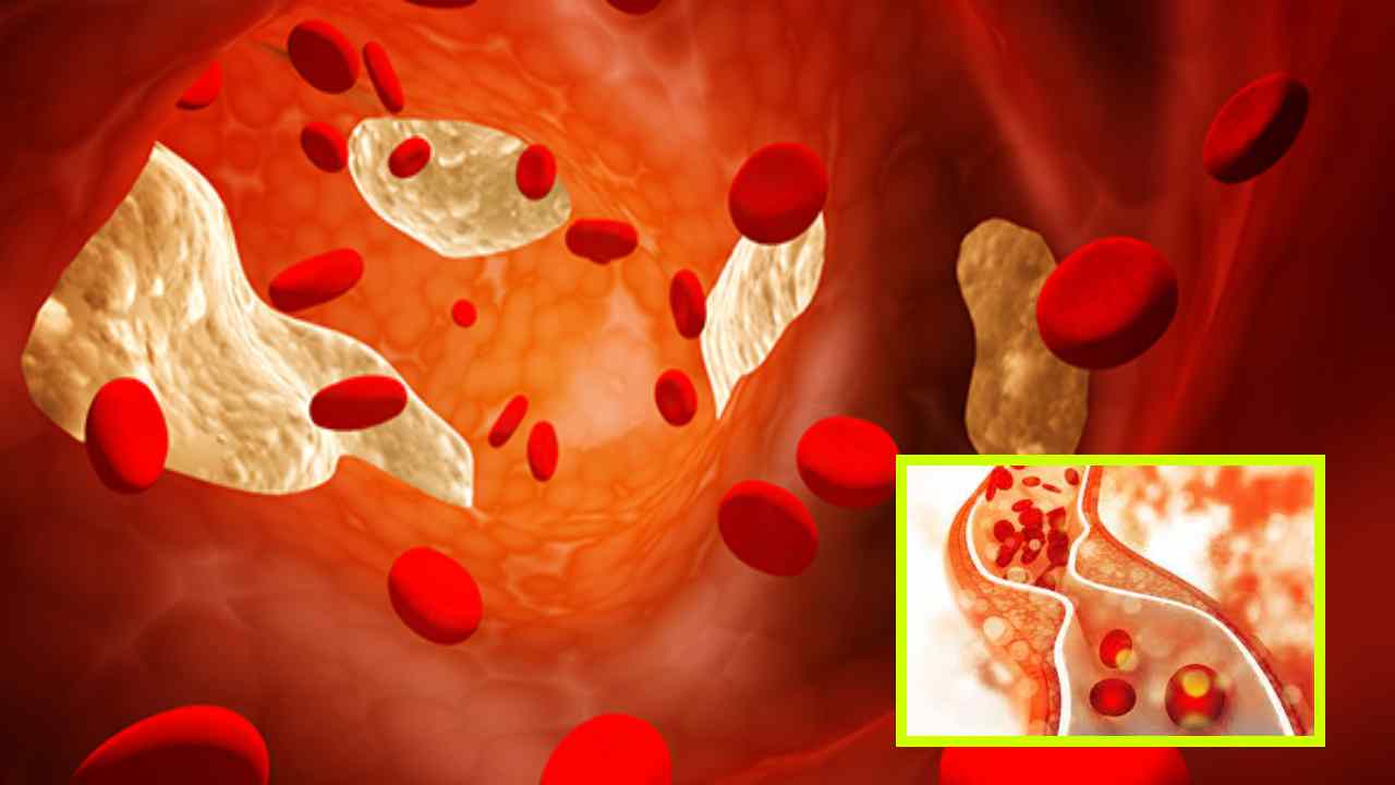 High Cholesterol : అధిక కొలెస్ట్రాల్ ప్రమాదాన్ని తగ్గించడంలో సహాయపడే ఆహార కలయికలు ఇవే ? High Cholesterol : అధిక కొలెస్ట్రాల్ ప్రమాదాన్ని తగ్గించడంలో సహాయపడే ఆహార కలయికలు ఇవే ?