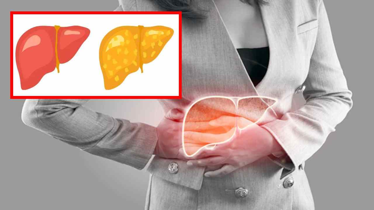 Fatty Liver Problem : ఫ్యాటీ లివర్ సమస్య మానసిక ఆరోగ్యాన్ని ఏవిధంగా ప్రభావితం చేస్తుందో తెలుసా ? Fatty Liver Problem : ఫ్యాటీ లివర్ సమస్య మానసిక ఆరోగ్యాన్ని ఏవిధంగా ప్రభావితం చేస్తుందో తెలుసా ?