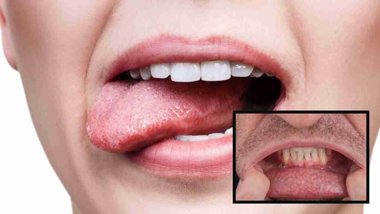 Oral Cancer : నోటి క్యాన్సర్కు కారణాలు ? దానిని నివారించడానికి చిట్కాలు ! Oral Cancer : నోటి క్యాన్సర్కు కారణాలు ? దానిని నివారించడానికి చిట్కాలు !