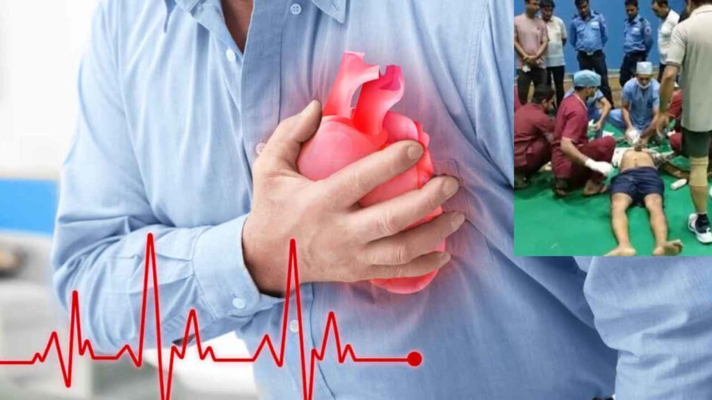 Heart Attack