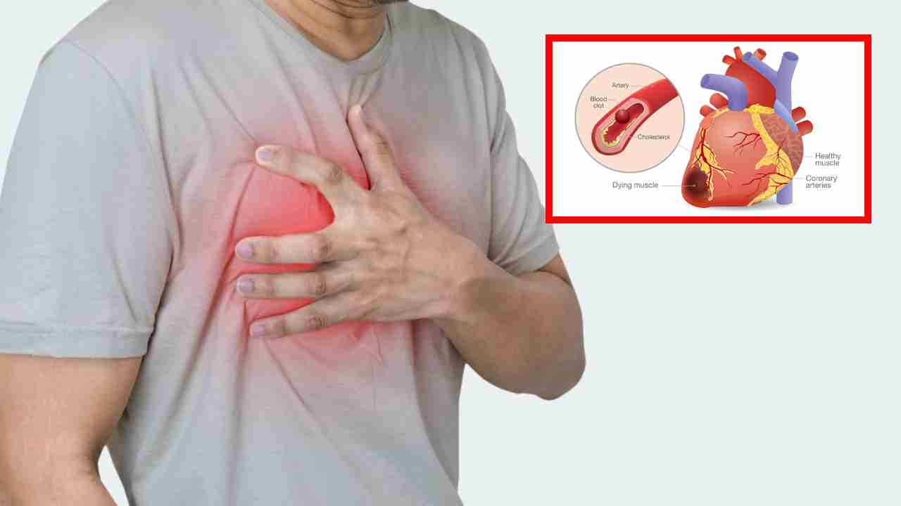 Heart Attack : కార్డియాక్ అరెస్ట్ , గుండెపోటుకు ప్రమాద కారకాలు, లక్షణాలు , నివారణ ! Heart Attack : కార్డియాక్ అరెస్ట్ , గుండెపోటుకు ప్రమాద కారకాలు, లక్షణాలు , నివారణ !