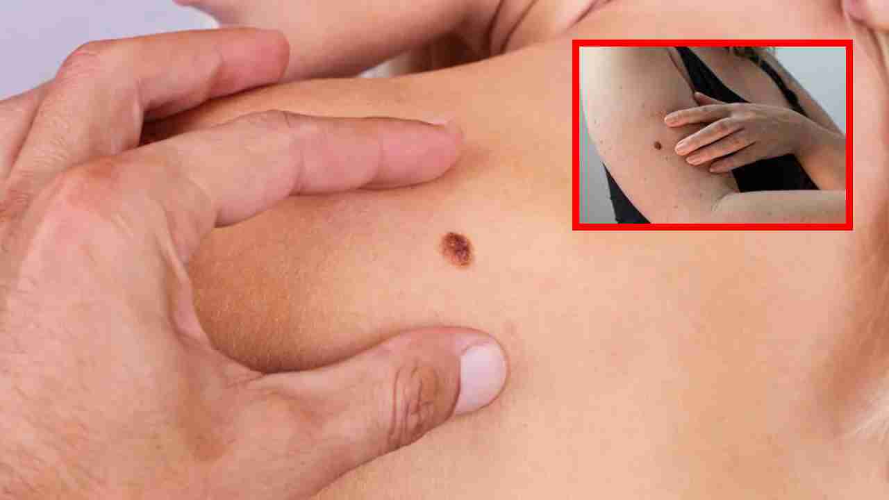 Symptoms Of Cancer : మీకు క్యాన్సర్ ఉంటే కనిపించే ముందస్తు సంకేతాలు ! Symptoms Of Cancer : మీకు క్యాన్సర్ ఉంటే కనిపించే ముందస్తు సంకేతాలు !