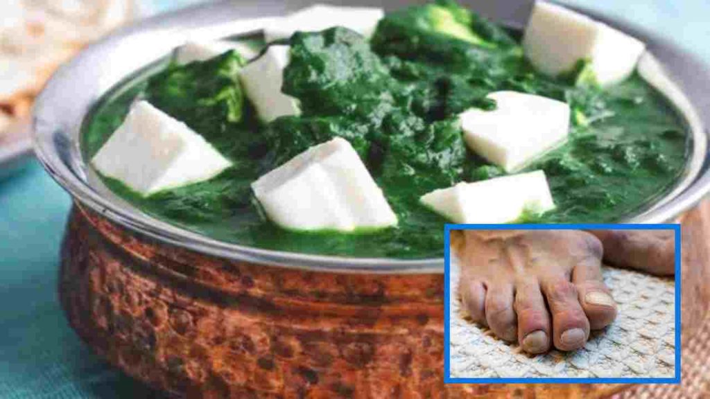 high uric acid