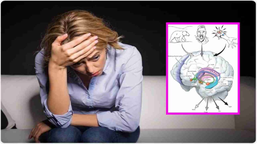 Anxiety Disorders