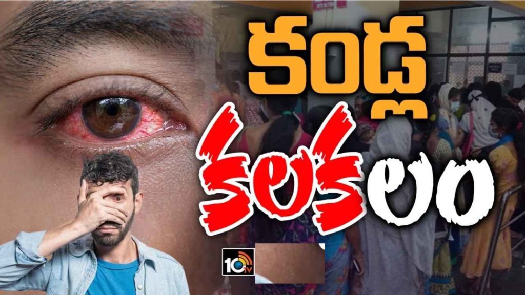 Conjunctivitis Spread in Telangana