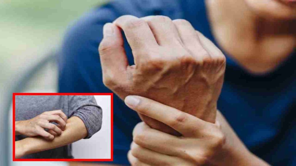 Diabetes and Your Skin