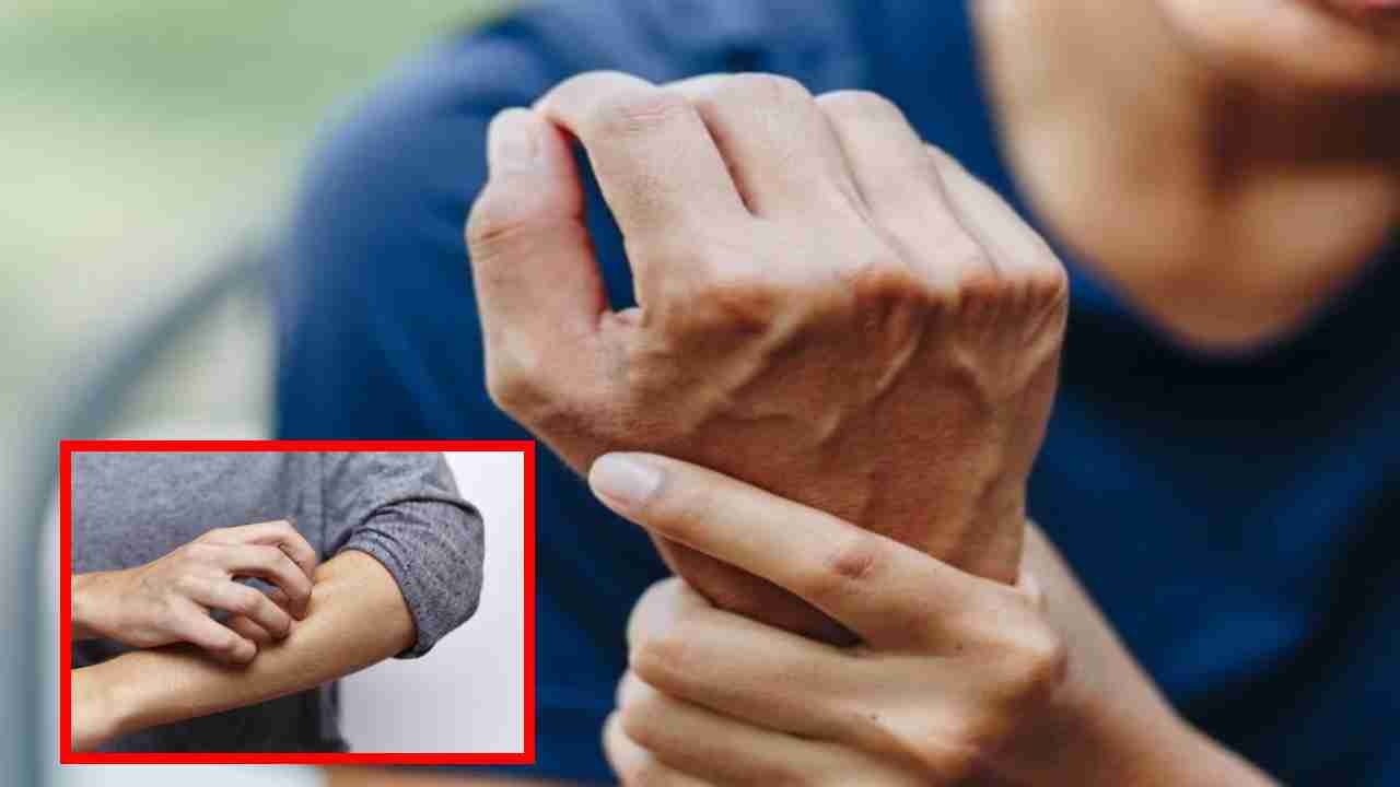 Skin Diseases In Diabetics : మధుమేహ బాధితుల్లో చర్మ వ్యాధులను ప్రేరేపించే వర్షాకాలం.. చర్మ ఆరోగ్యం కోసం అనుసరించాల్సిన విధానాలు ! Skin Diseases In Diabetics : మధుమేహ బాధితుల్లో చర్మ వ్యాధులను ప్రేరేపించే వర్షాకాలం.. చర్మ ఆరోగ్యం కోసం అనుసరించాల్సిన విధానాలు !