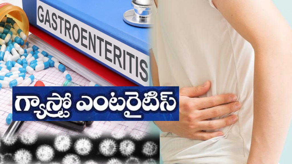 Gastroenteritis symptoms causes and treatment details in Telugu