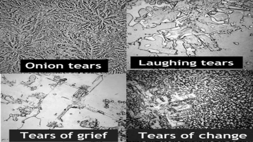 Different Types of Tears