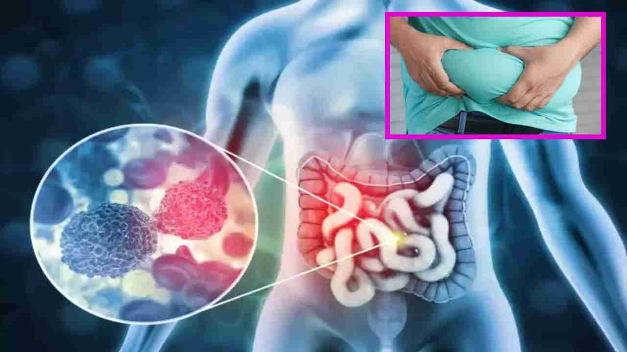 Obesity and Cancer : ఊబకాయంతో క్యాన్సరు వచ్చే ప్రమాదం ఉందా ? Obesity and Cancer : ఊబకాయంతో క్యాన్సరు వచ్చే ప్రమాదం ఉందా ?