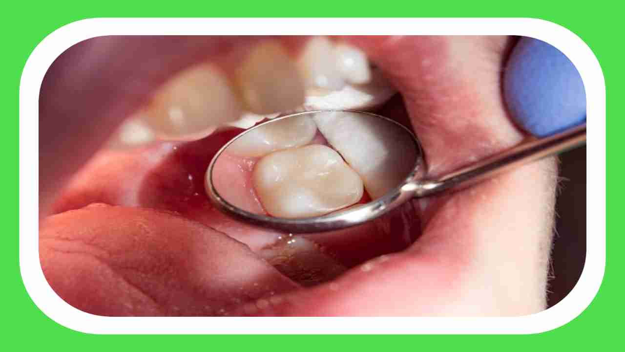 Dental Health : దంత ఆరోగ్యం విషయంలో చాలా మందిలో నెలకొన్న అపోహలు Vs వాస్తవాలు ! Dental Health : దంత ఆరోగ్యం విషయంలో చాలా మందిలో నెలకొన్న అపోహలు Vs వాస్తవాలు !