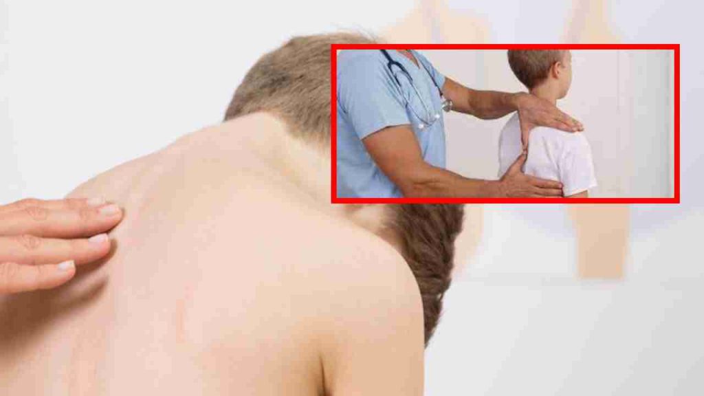 Scoliosis