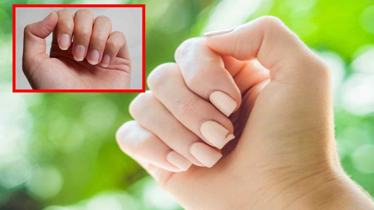 Brittle Nails : గోళ్లు విరుగుతున్నాయా… జాగ్రత్త Brittle Nails : గోళ్లు విరుగుతున్నాయా… జాగ్రత్త